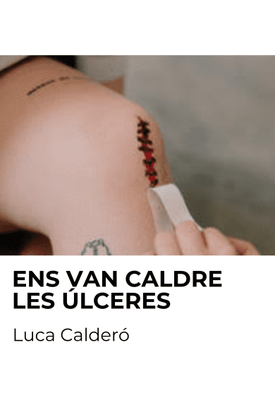 Ens van caldre les úlceres
